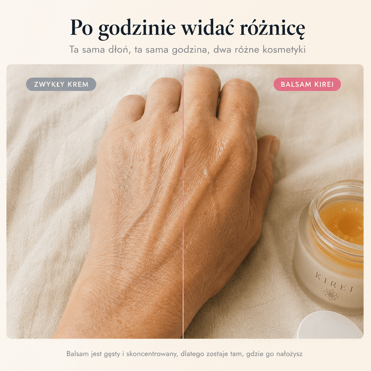 Metoda Yotsu, trzy etapy w skórze