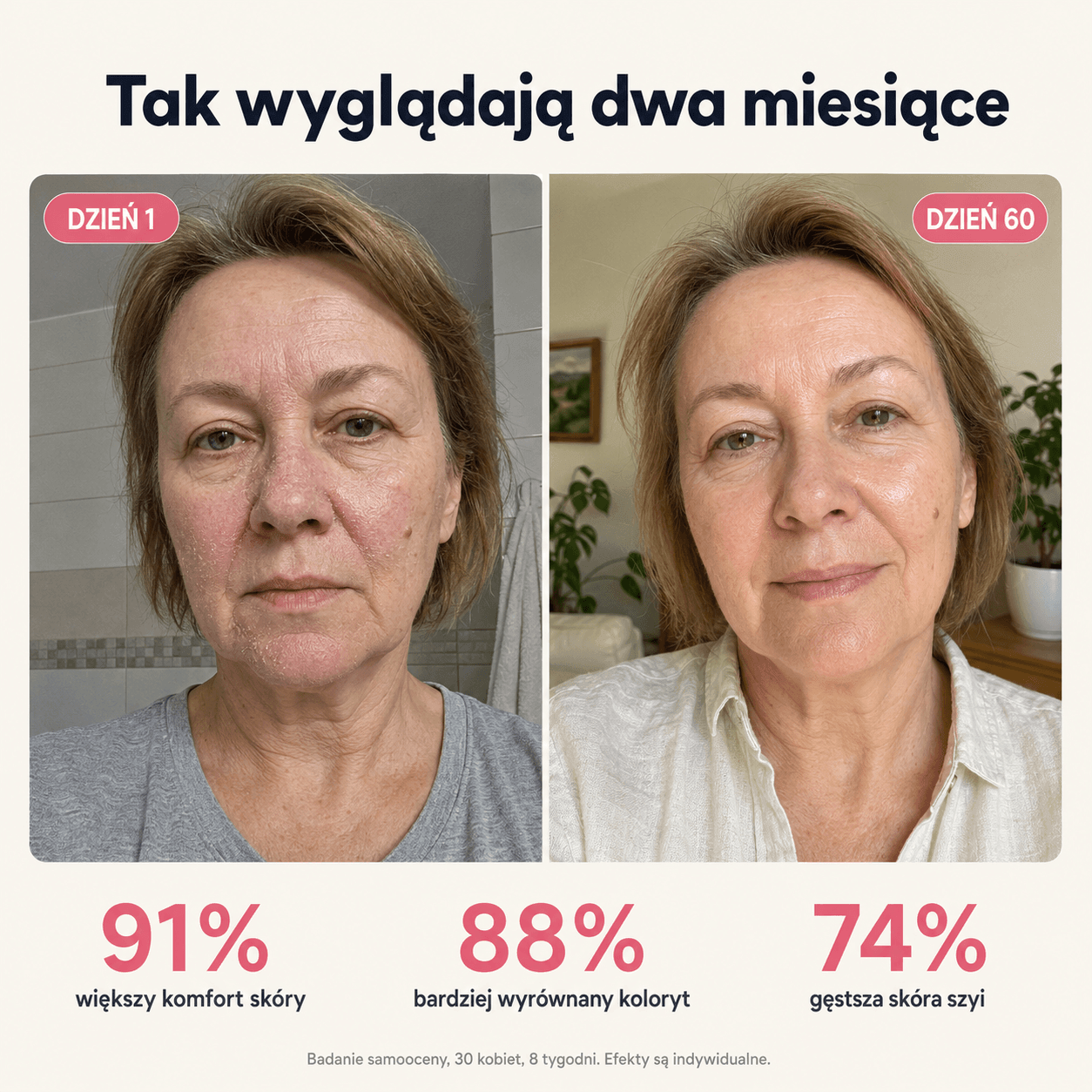 Skóra w dniu pierwszym i po sześćdziesięciu dniach