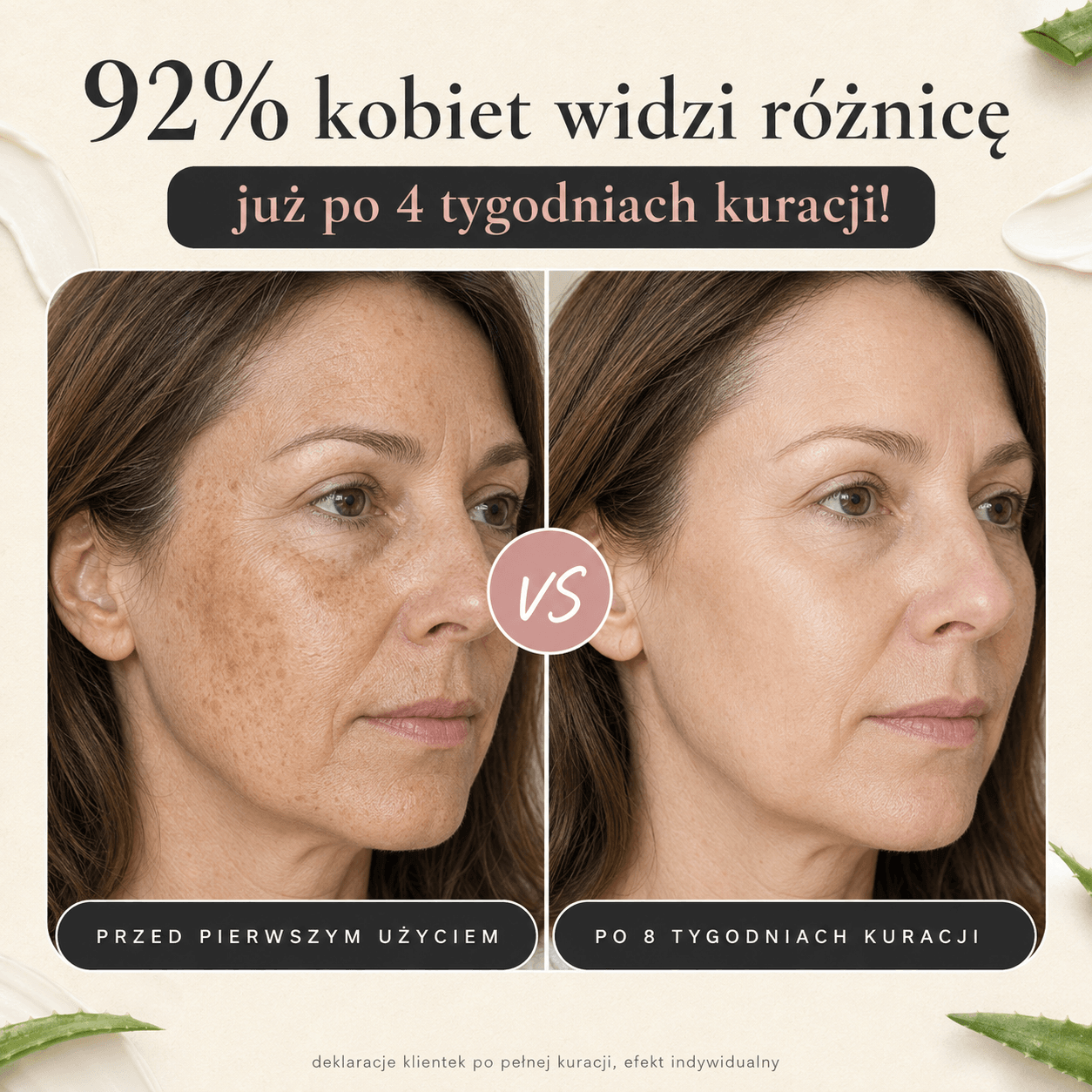 Koloryt w dniu pierwszym i po pełnej kuracji